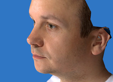 Nose Size Simulation